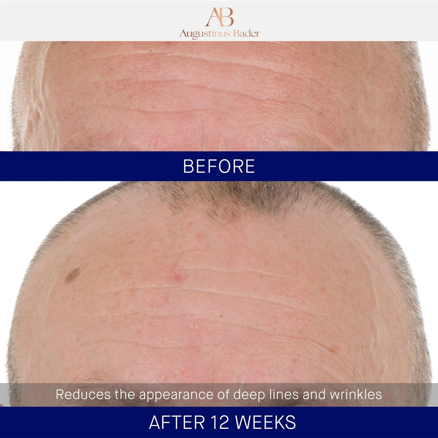 AUGUSTINUS BADER THE RETINOL SERUM 30ml