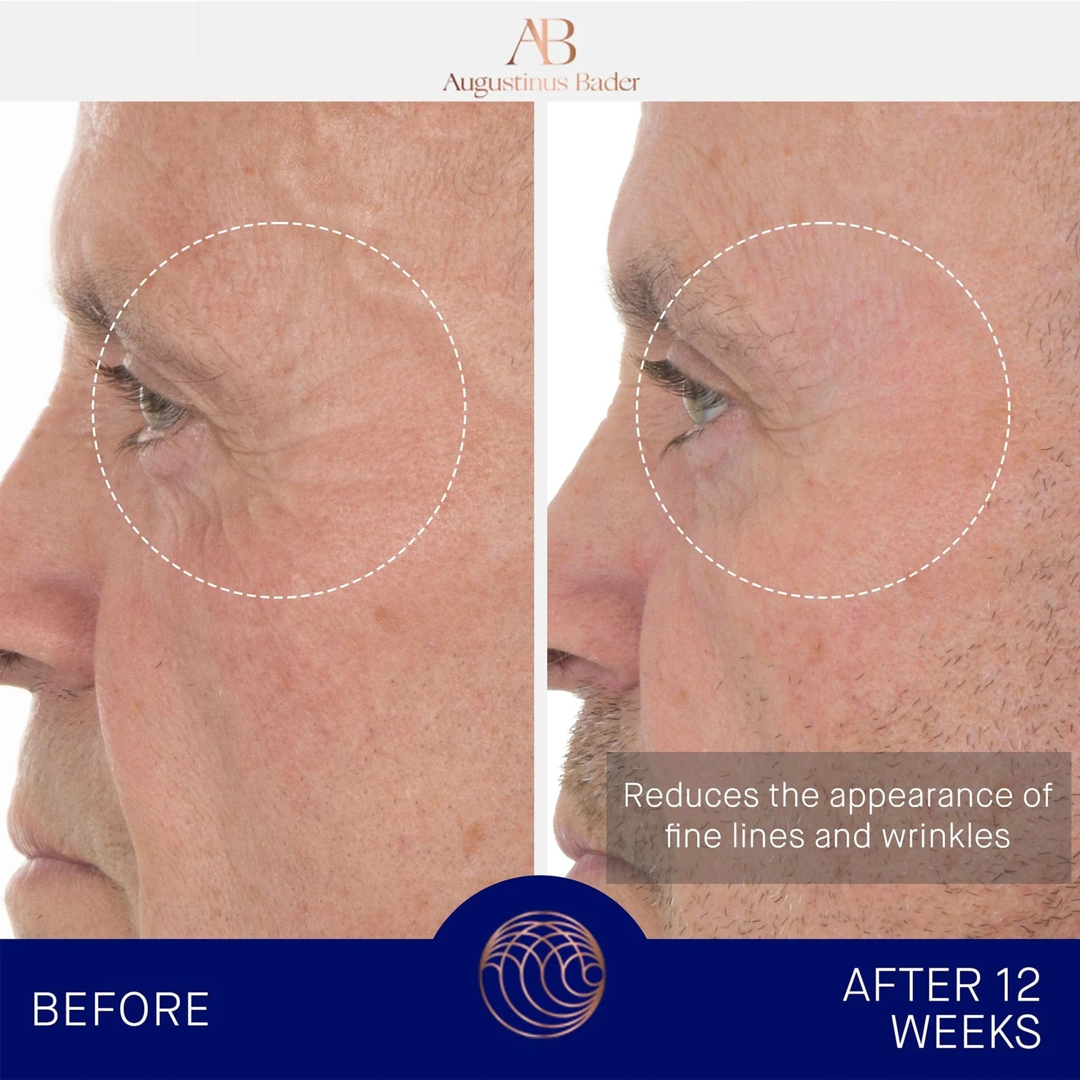 AUGUSTINUS BADER THE RETINOL SERUM 30ml